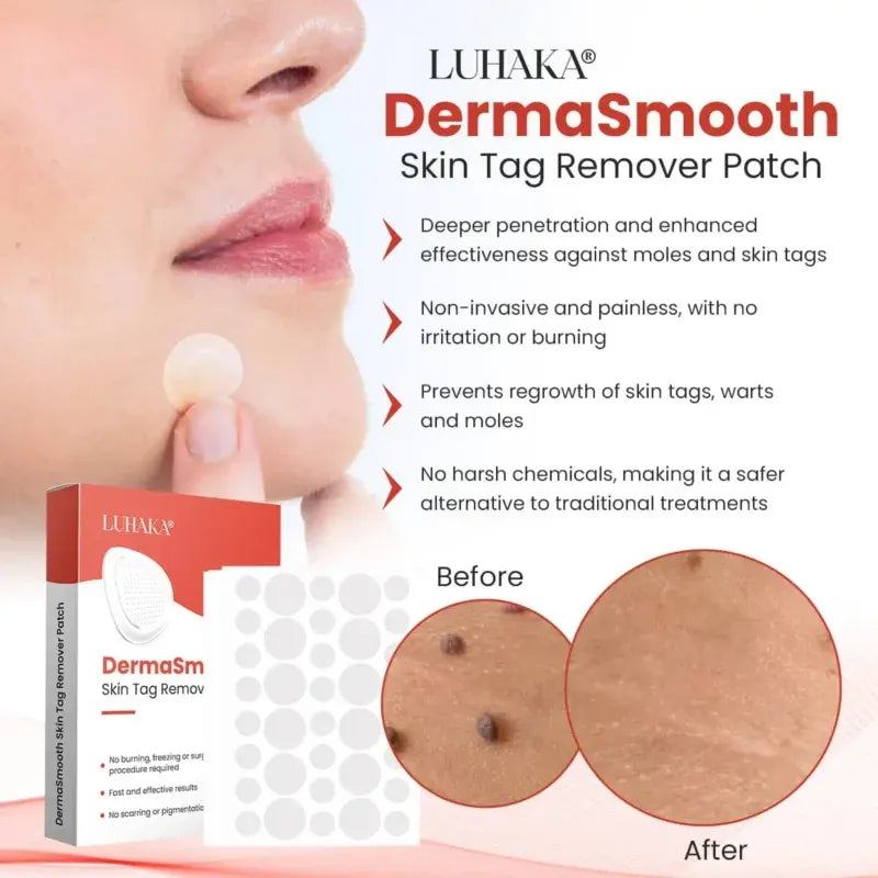 - Derma Smooth Skin Tag Removal Patch - ✨ 100% Results- Ummati Essentials