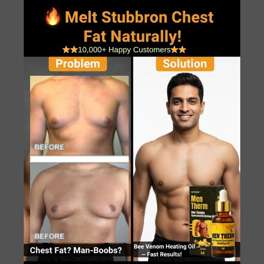 Chest Fat Bee Venom Gynecomastia Heating Oil - Ummati Essentials
