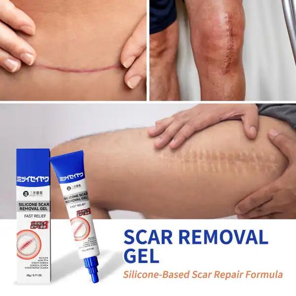 Silicone Scar Cream for Old and New Scars - Ummati_Essentials