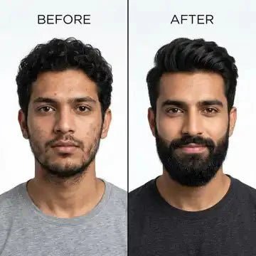 Dr. Alies Professional Beard Growth Oil – Natural 30ml - Ummati_Essentials