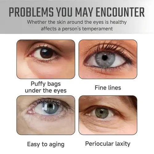 Lutein Anti - Wrinkle Serum – Firm & Radiant Skin - Ummati Essentials