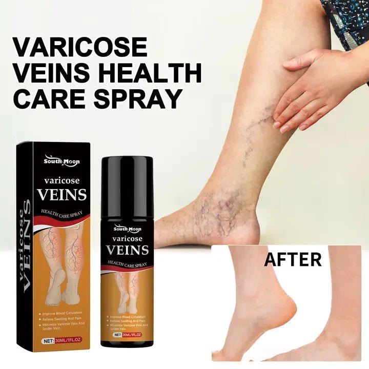 Varicose Vein Relief Spray - Ummati Essentials