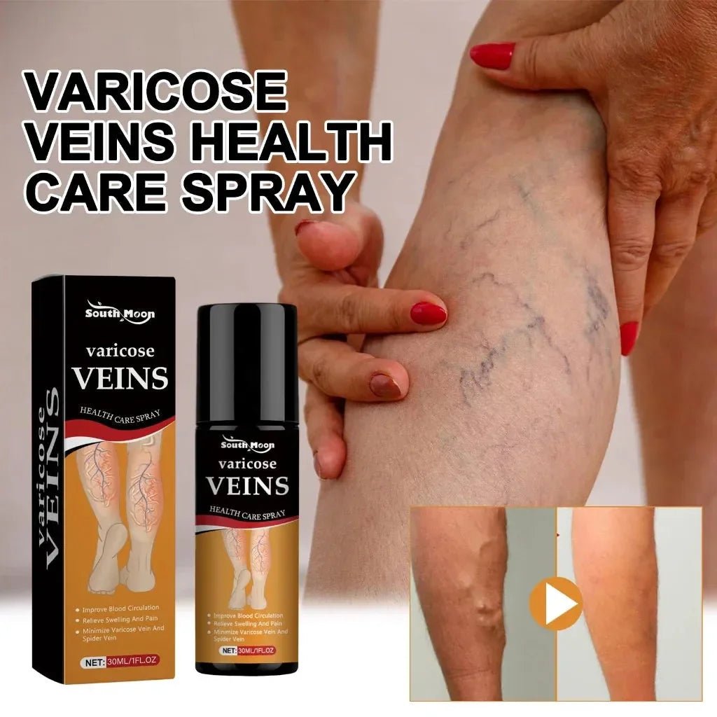 Varicose Vein Relief Spray - Ummati Essentials